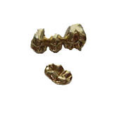 Scrap Gold buyers of Scrap Dental Gold such as gold teeth